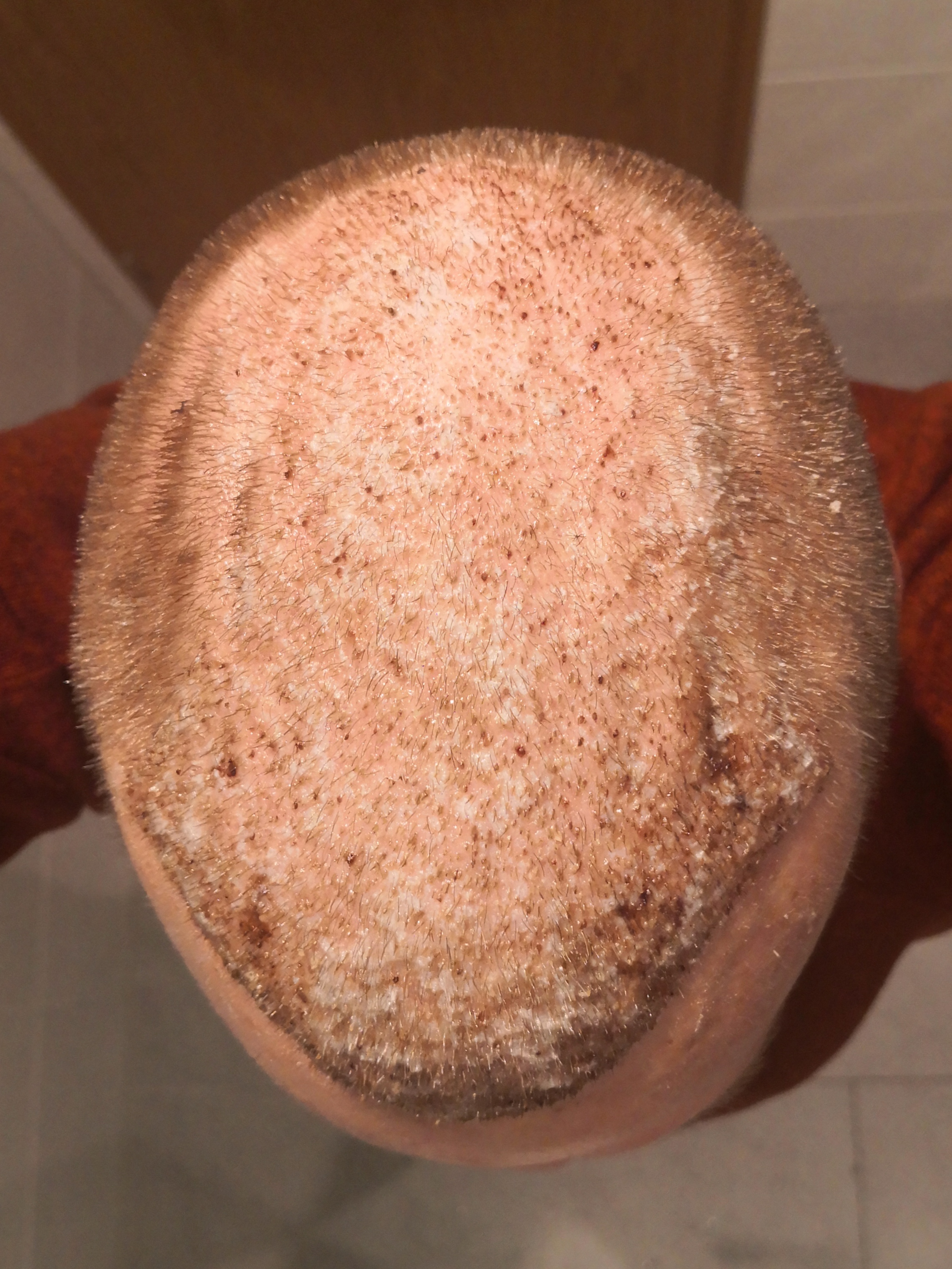 /foren/transplant/index.php/fa/62996/0/