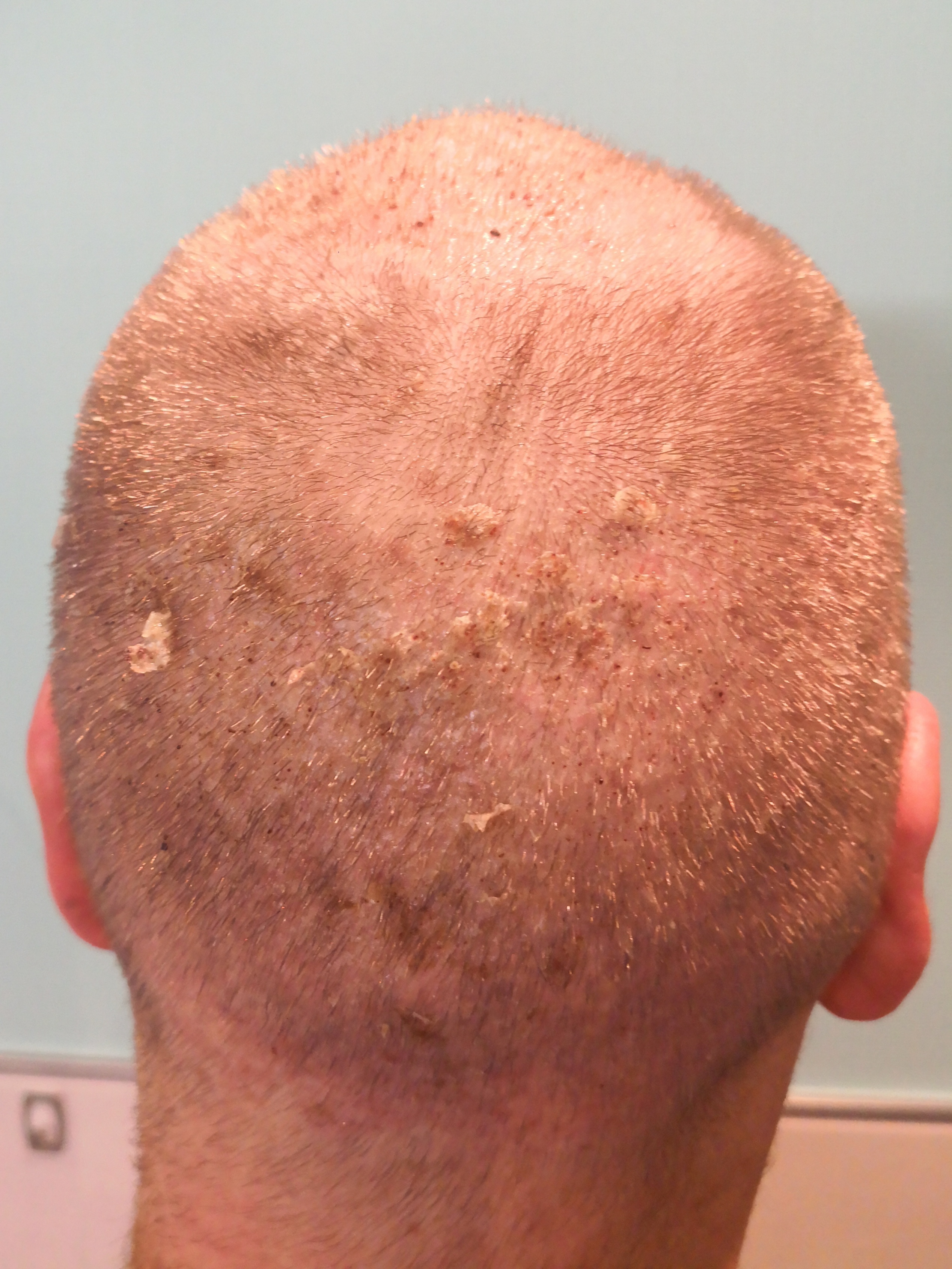 /foren/transplant/index.php/fa/62997/0/