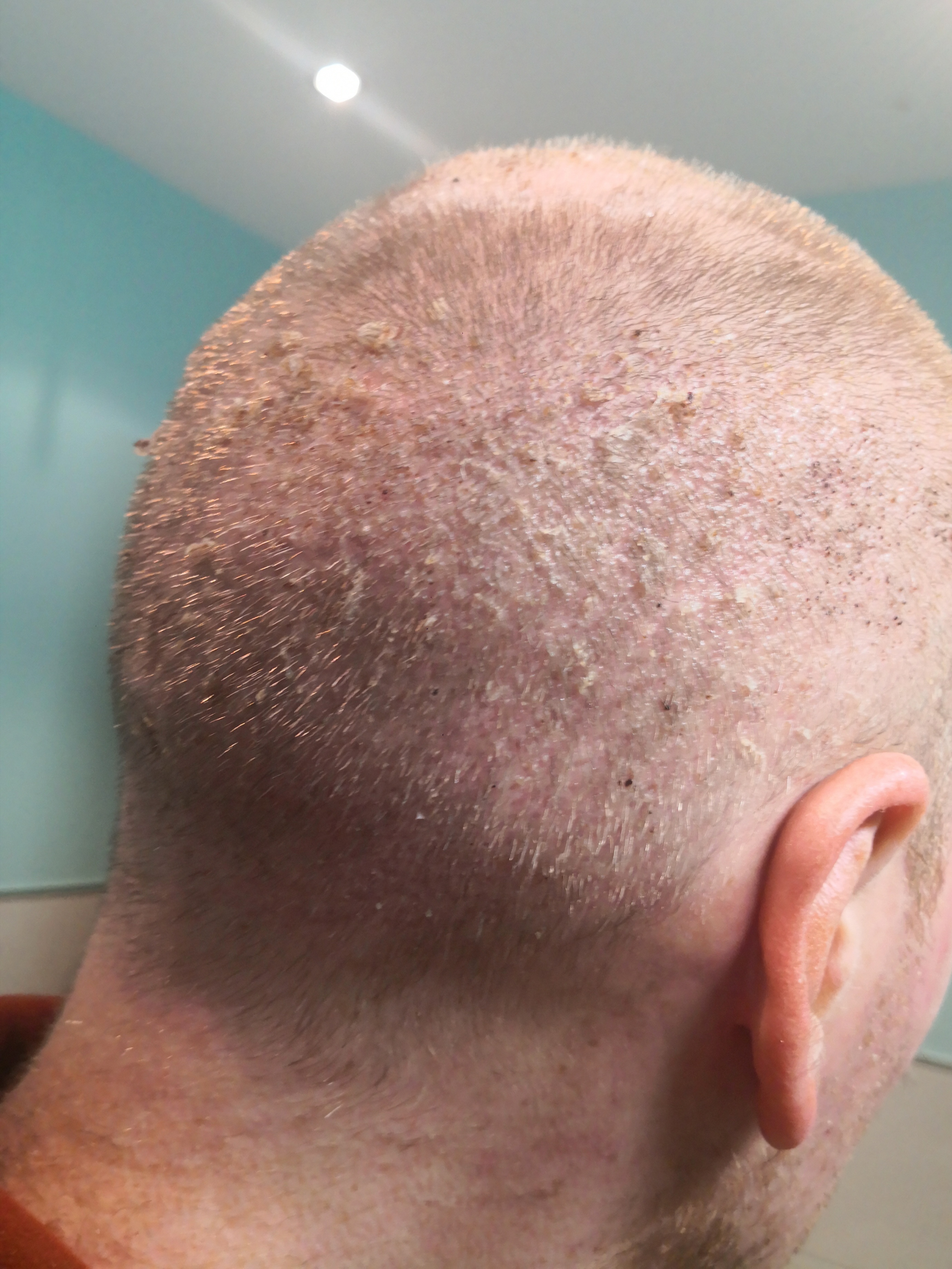 /foren/transplant/index.php/fa/62998/0/