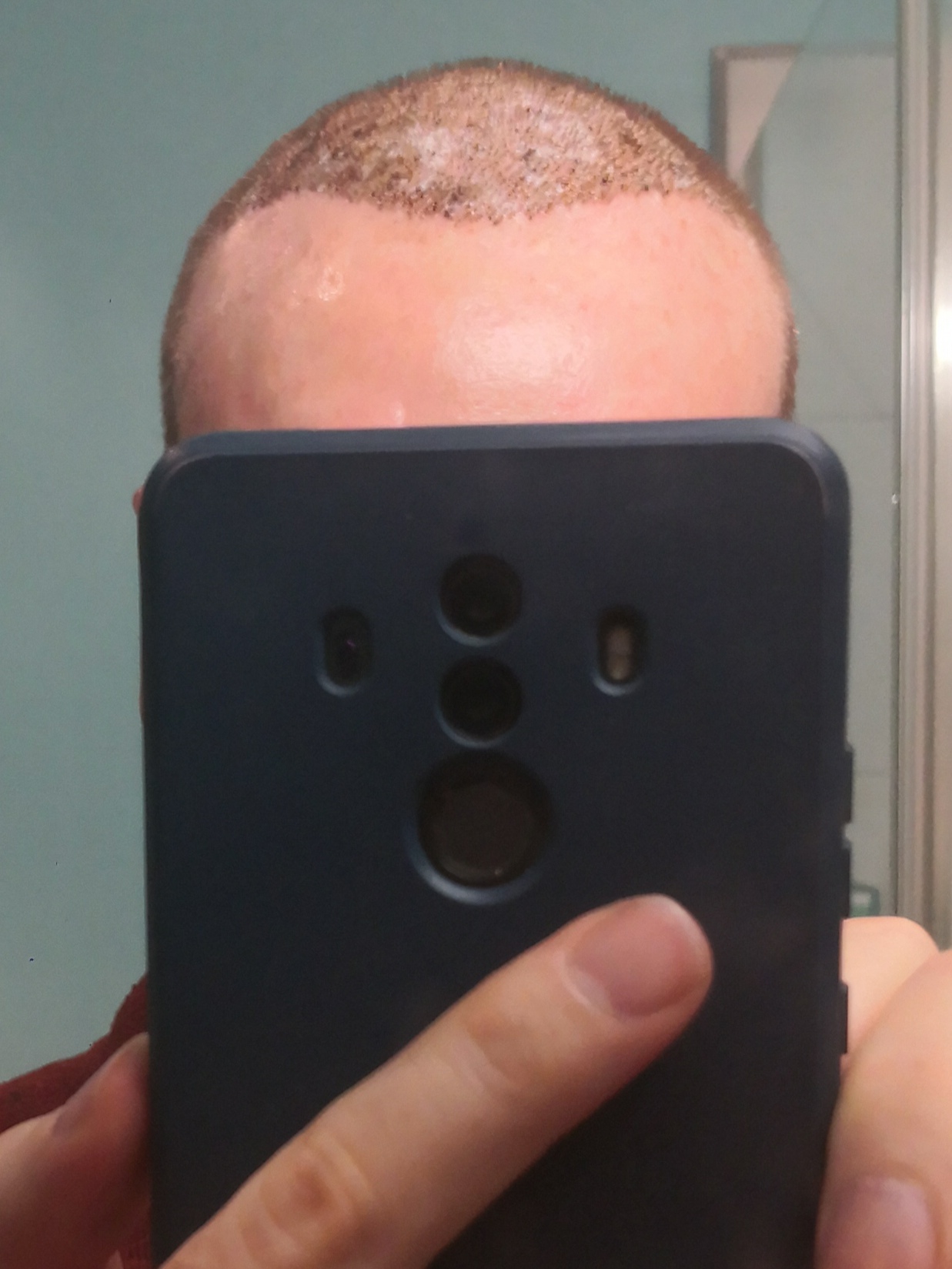 /foren/transplant/index.php/fa/62999/0/