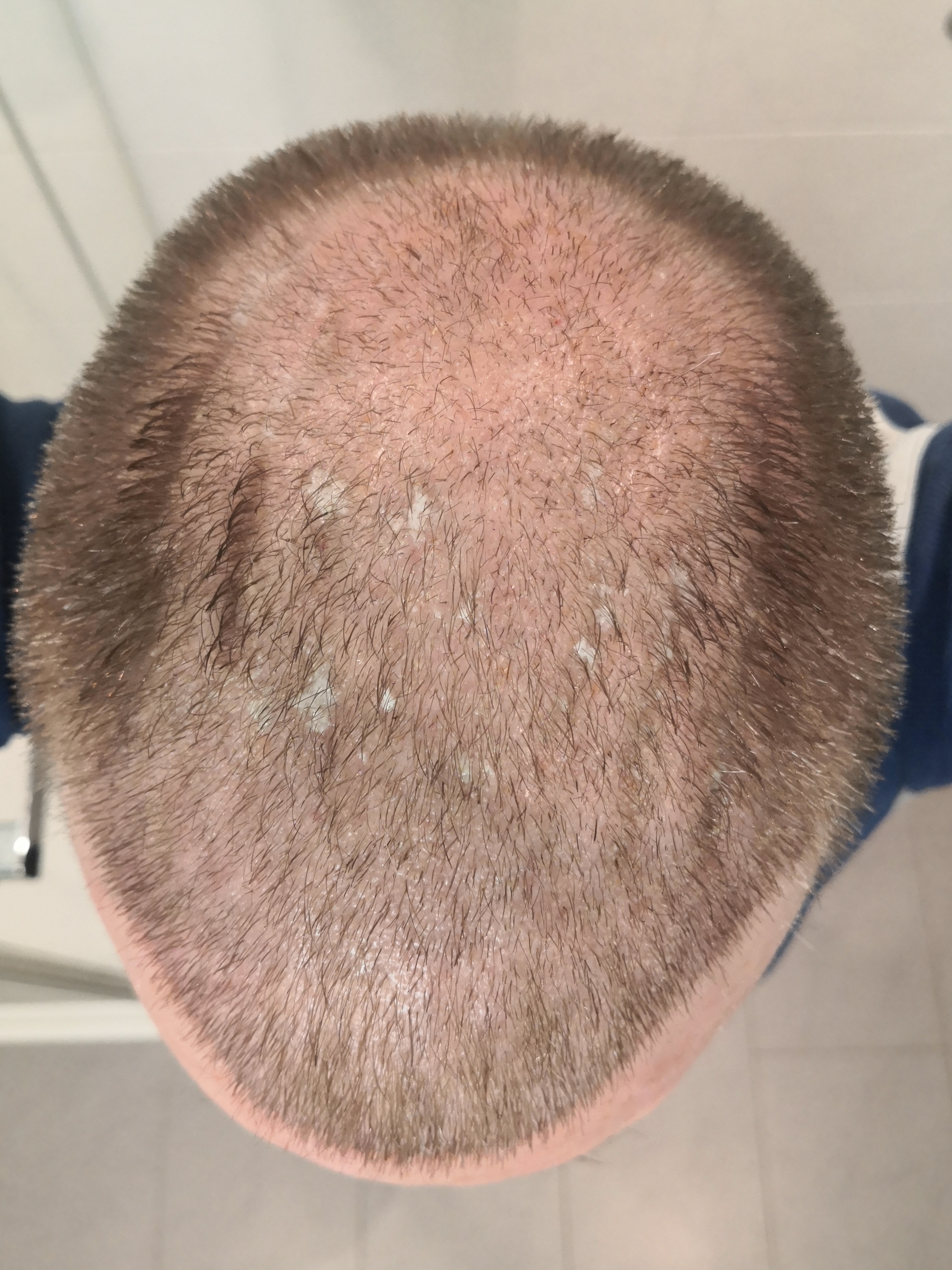 /foren/transplant/index.php/fa/63022/0/