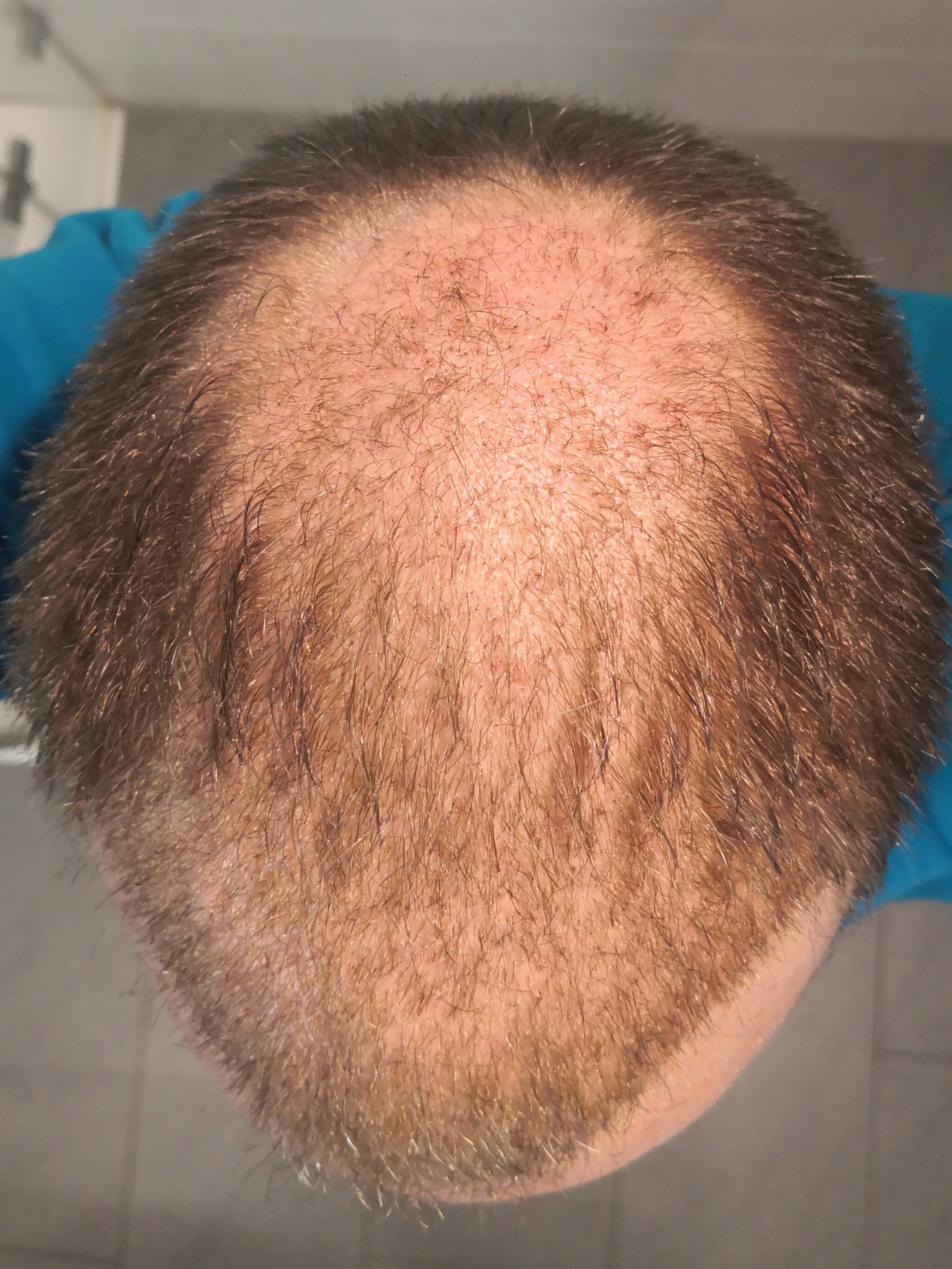 /foren/transplant/index.php/fa/63113/0/