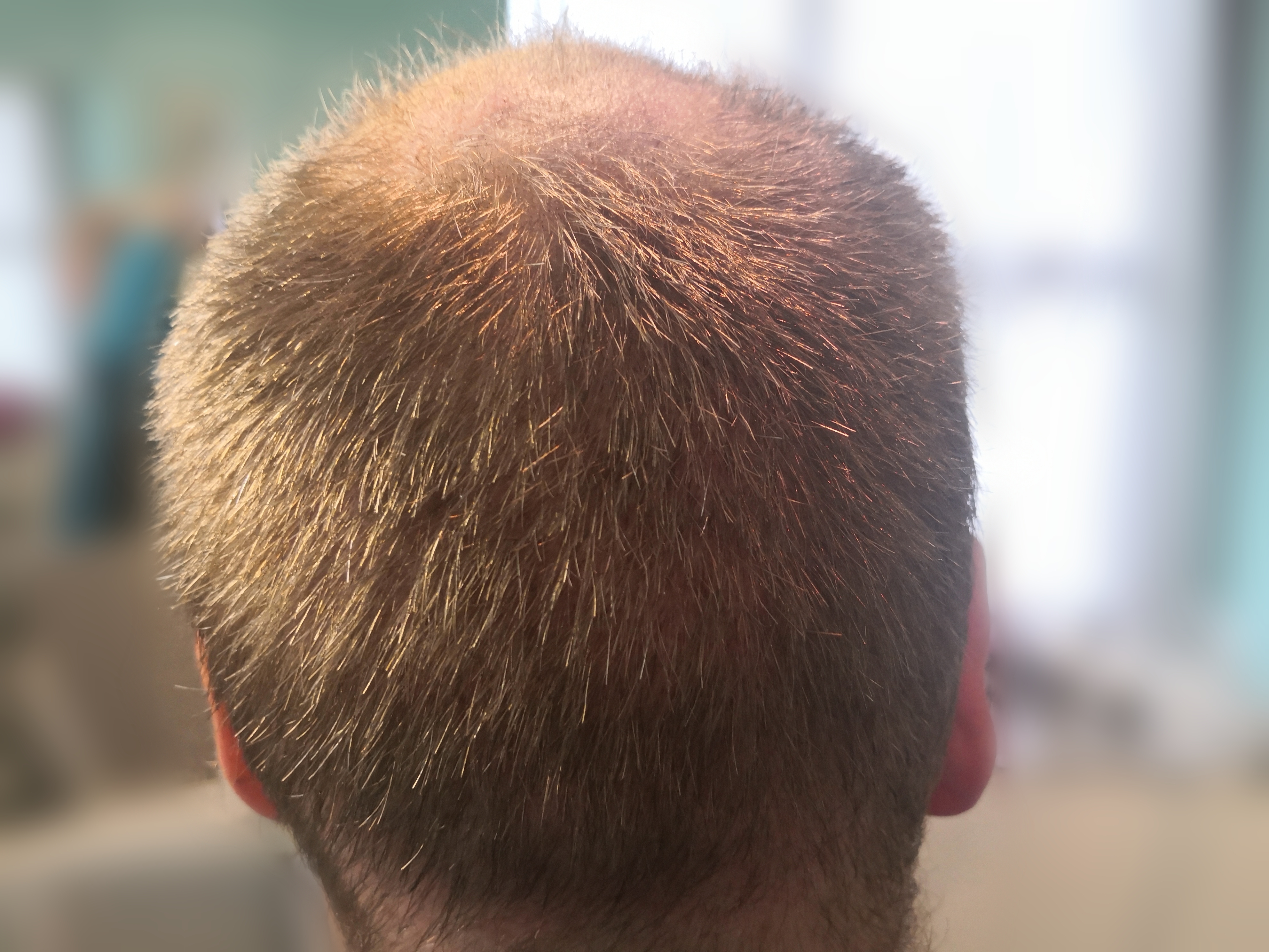 /foren/transplant/index.php/fa/63114/0/