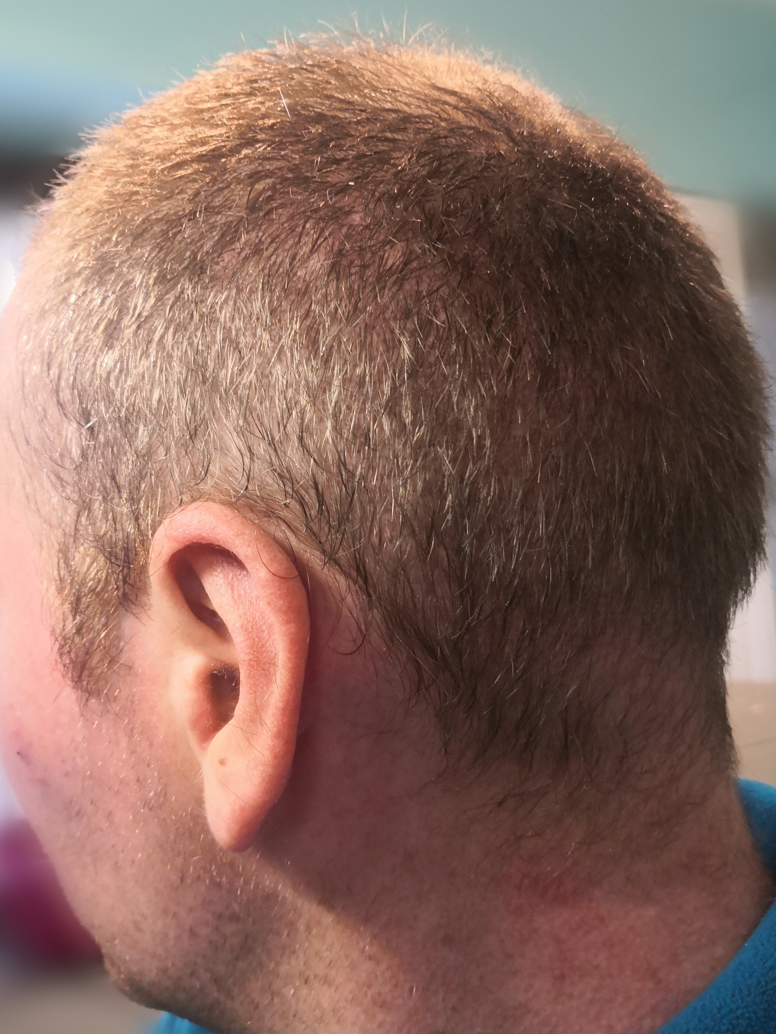 /foren/transplant/index.php/fa/63115/0/