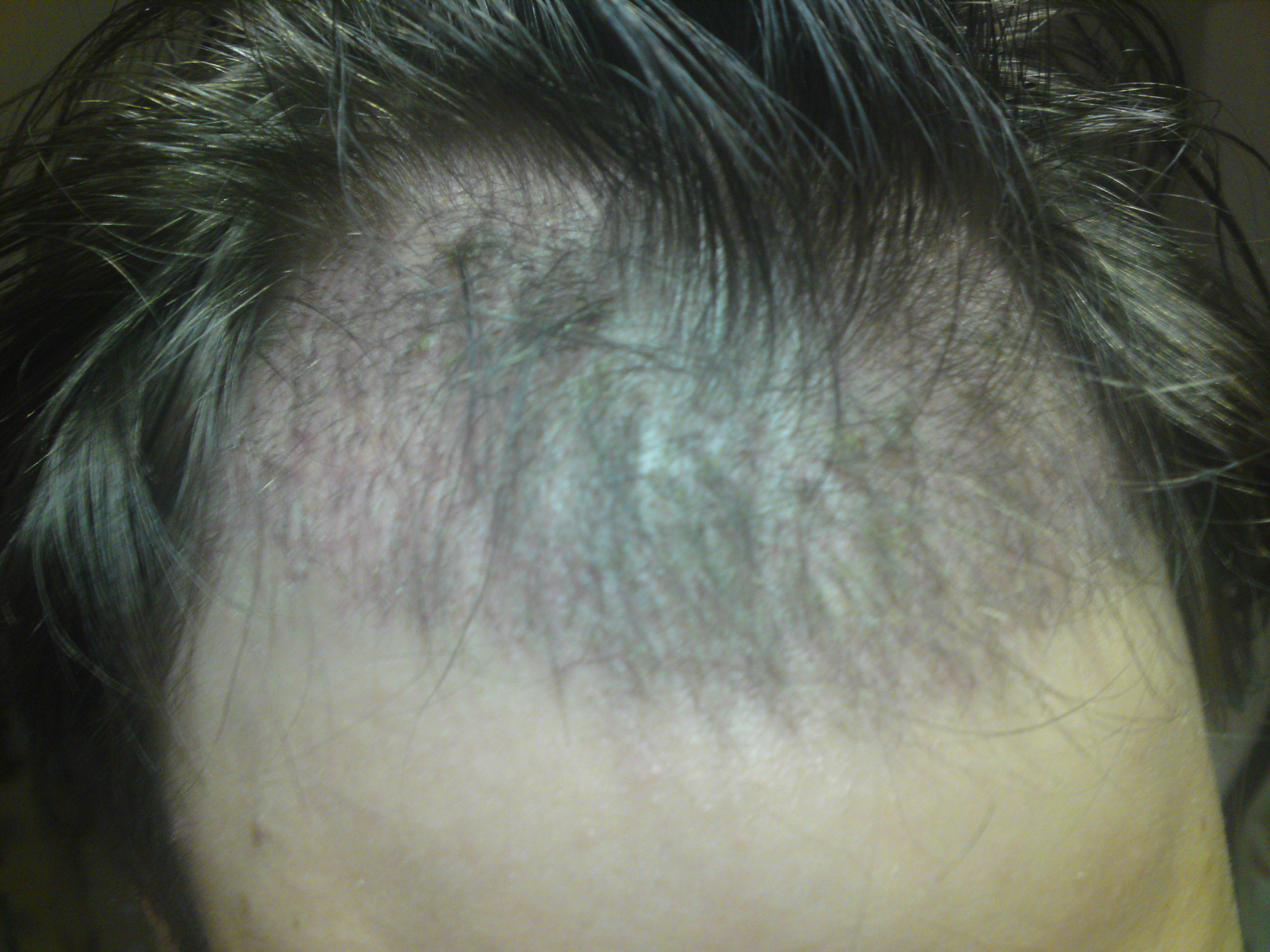 index.php/fa/6314/0/