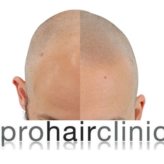 /foren/transplant/index.php/fa/63150/0/