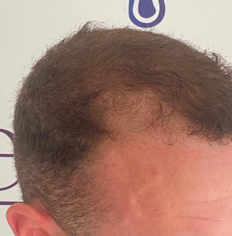 /foren/transplant/index.php/fa/63189/0/