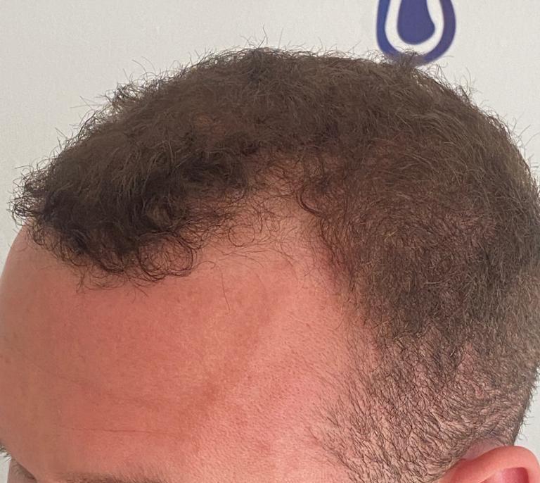 /foren/transplant/index.php/fa/63190/0/