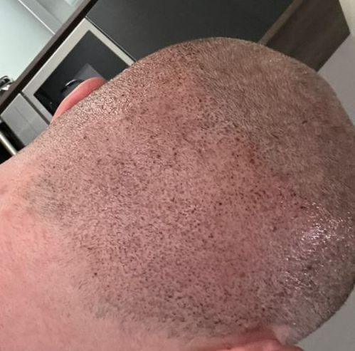 /foren/transplant/index.php/fa/63194/0/