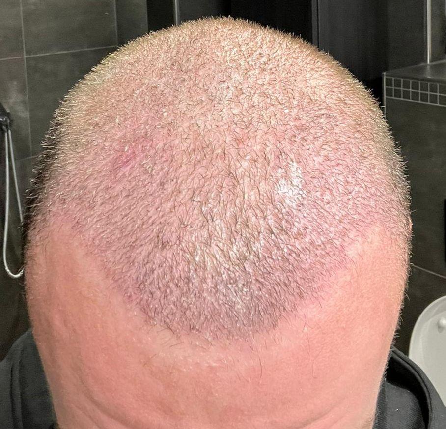 /foren/transplant/index.php/fa/63195/0/