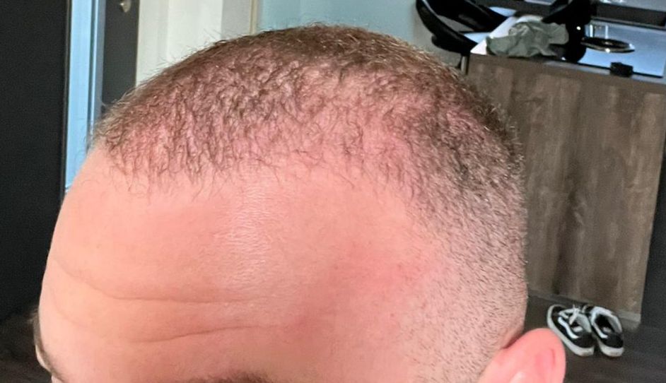 /foren/transplant/index.php/fa/63197/0/