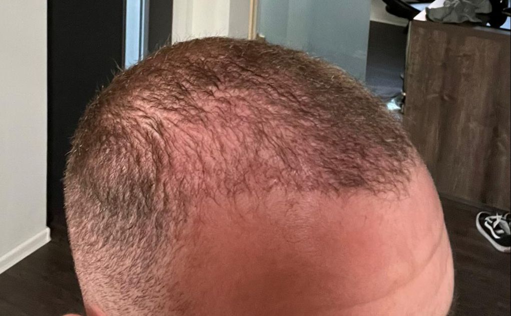 /foren/transplant/index.php/fa/63199/0/