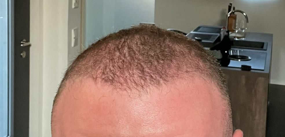 /foren/transplant/index.php/fa/63200/0/