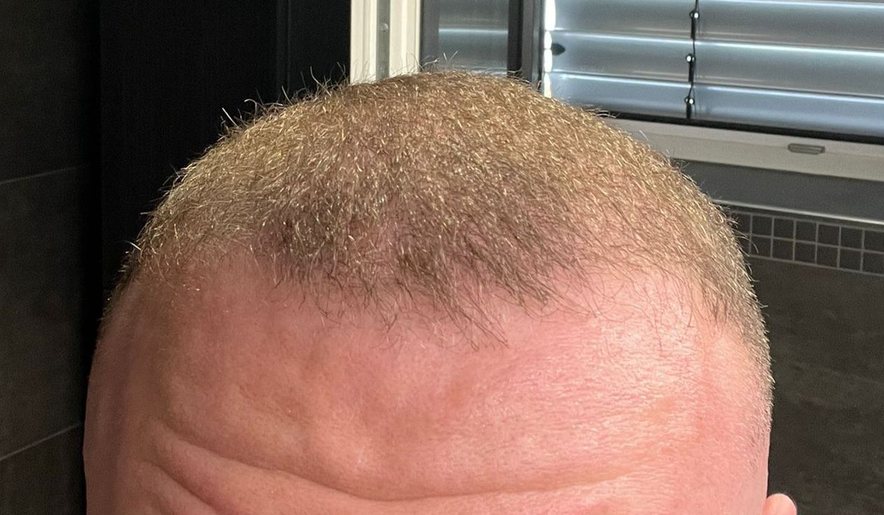 /foren/transplant/index.php/fa/63201/0/