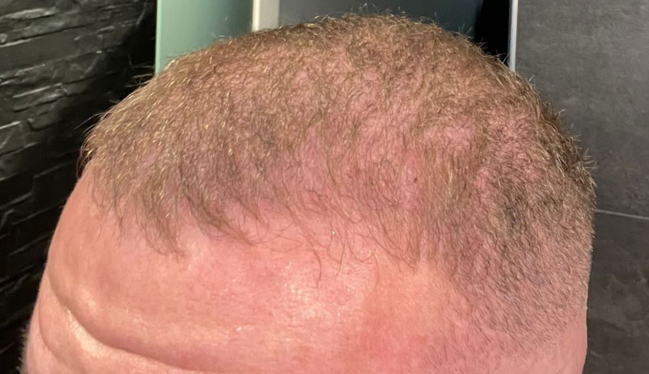 /foren/transplant/index.php/fa/63202/0/