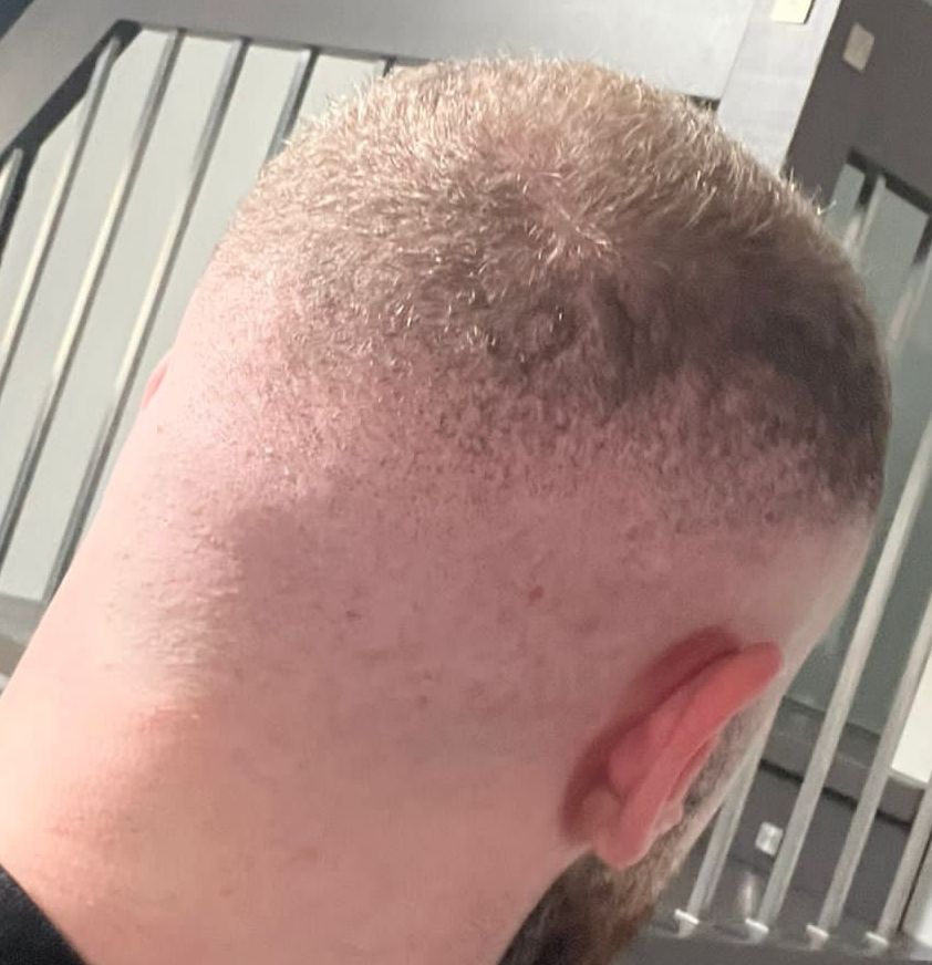 /foren/transplant/index.php/fa/63203/0/