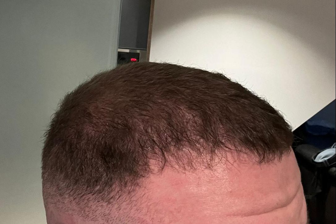 /foren/transplant/index.php/fa/63204/0/