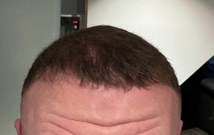 /foren/transplant/index.php/fa/63205/0/