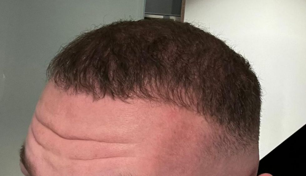 /foren/transplant/index.php/fa/63206/0/