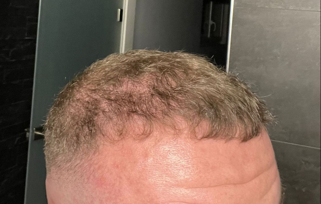 /foren/transplant/index.php/fa/63209/0/