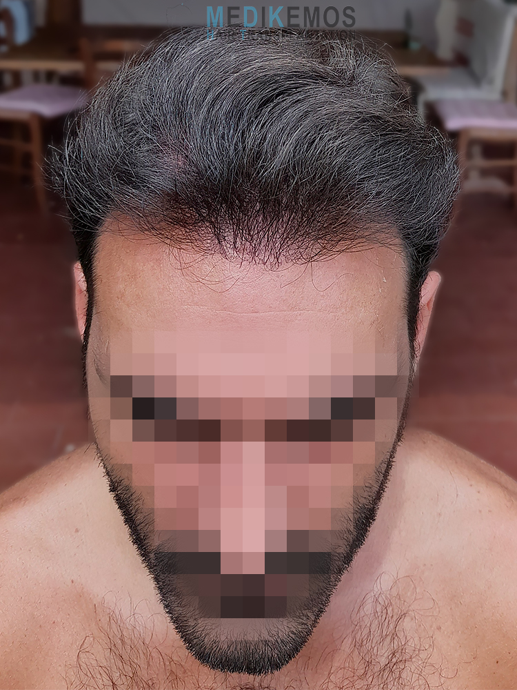 /foren/transplant/index.php/fa/63324/0/