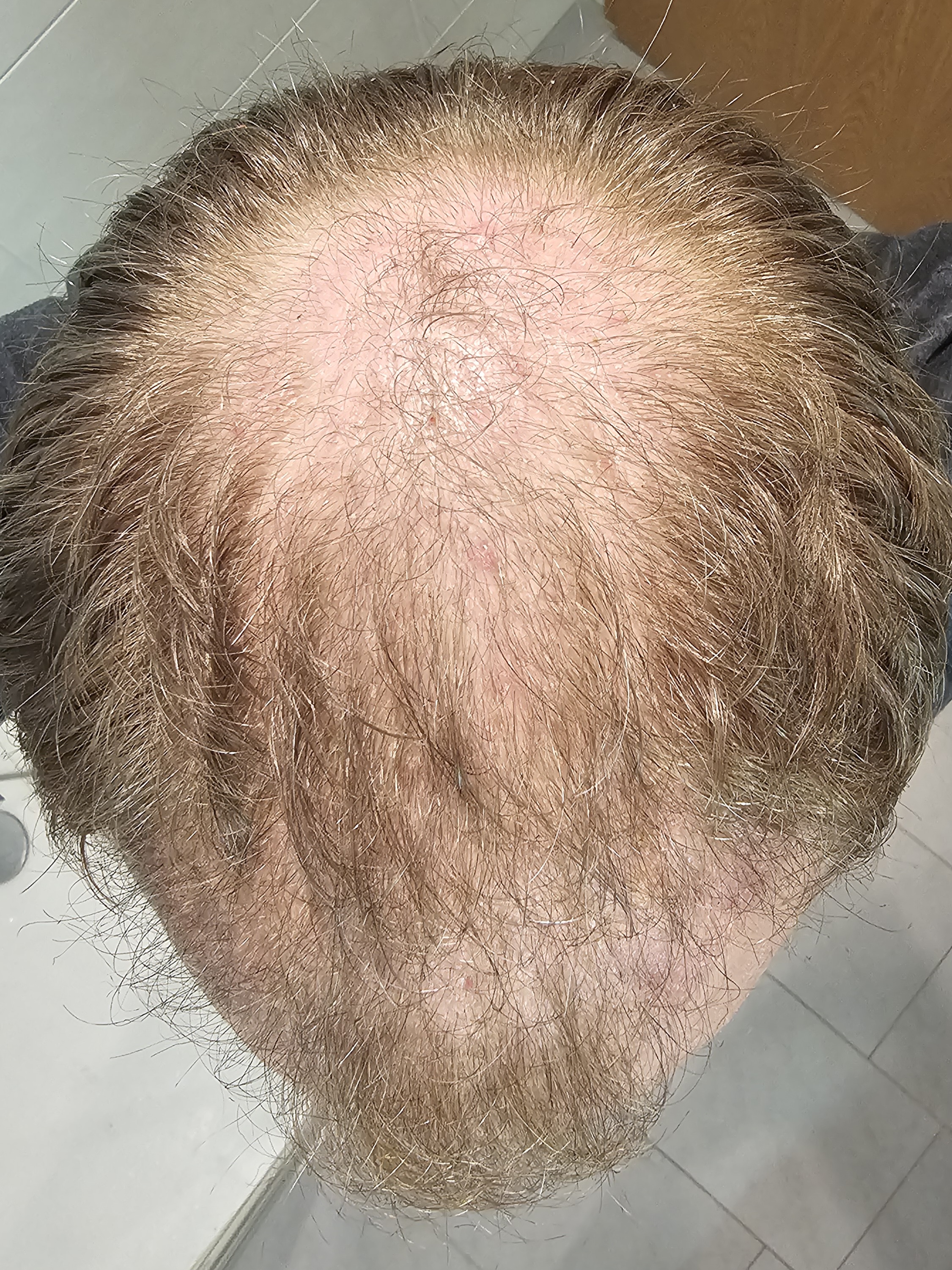 /foren/transplant/index.php/fa/63438/0/