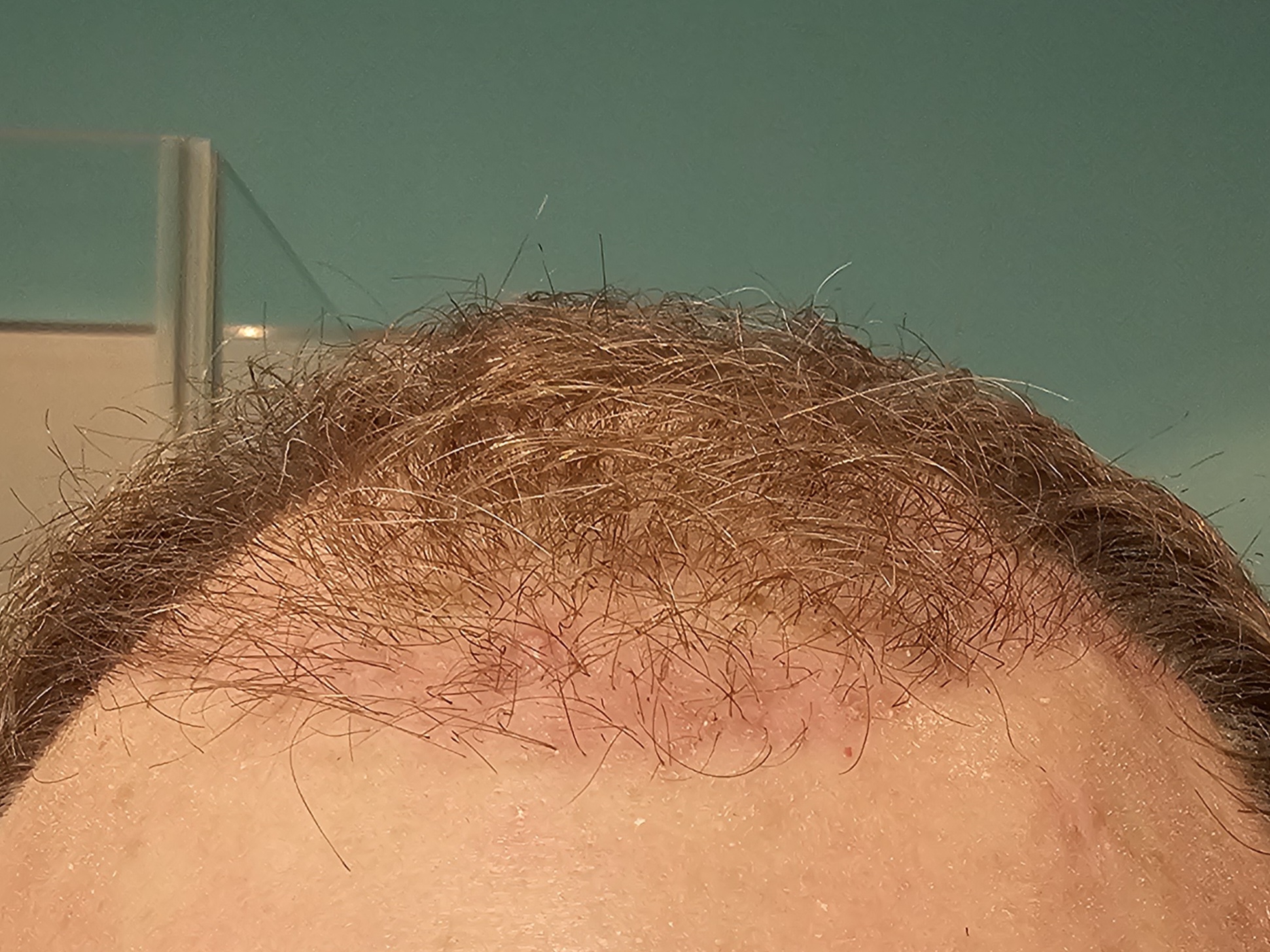 /foren/transplant/index.php/fa/63439/0/