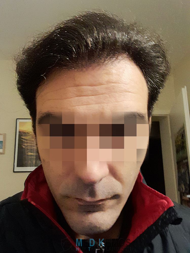 /foren/transplant/index.php/fa/63555/0/