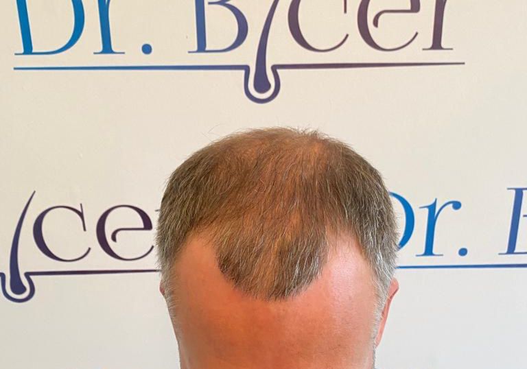 /foren/transplant/index.php/fa/63698/0/