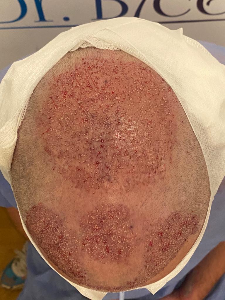 /foren/transplant/index.php/fa/63701/0/