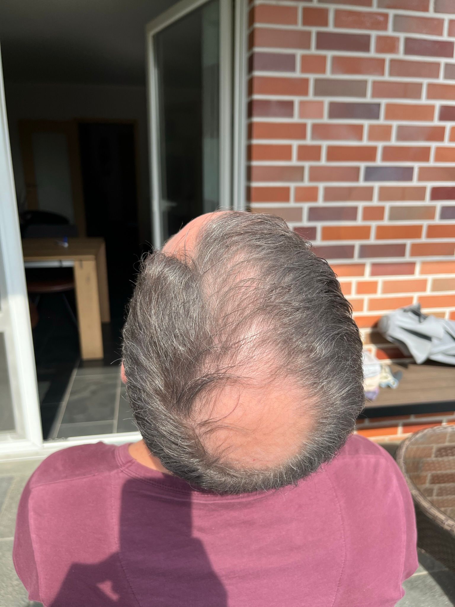 /foren/transplant/index.php/fa/63795/0/