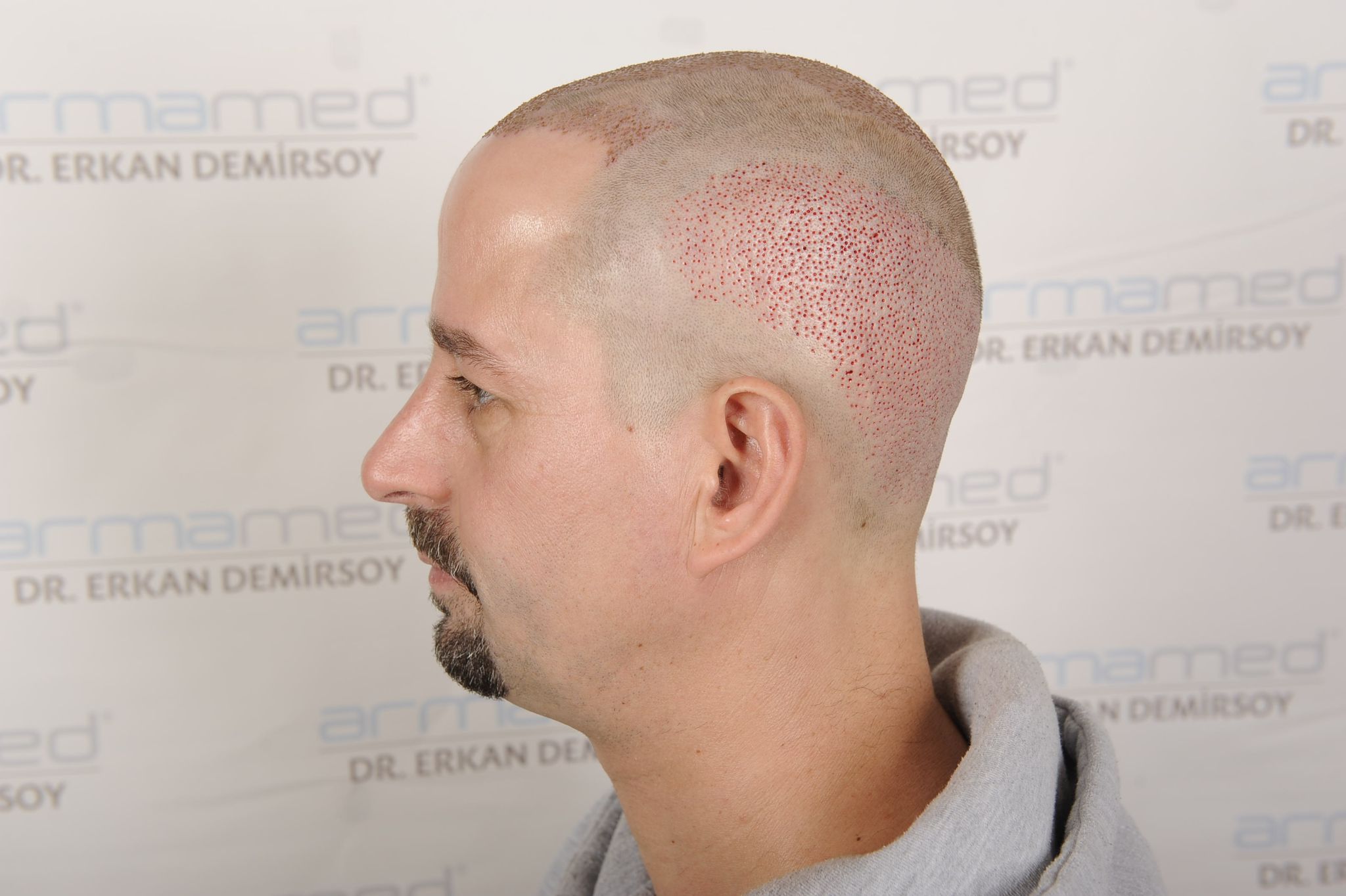 /foren/transplant/index.php/fa/63797/0/