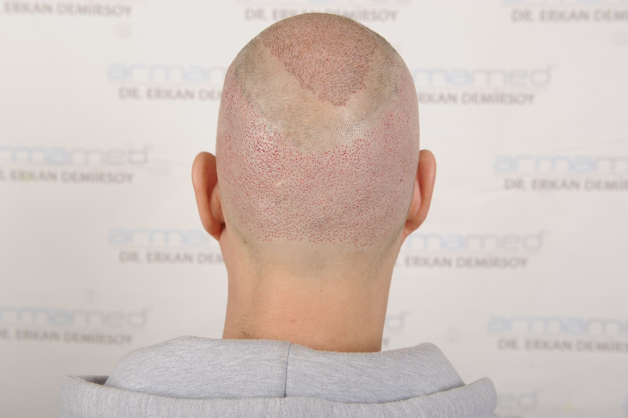 /foren/transplant/index.php/fa/63799/0/