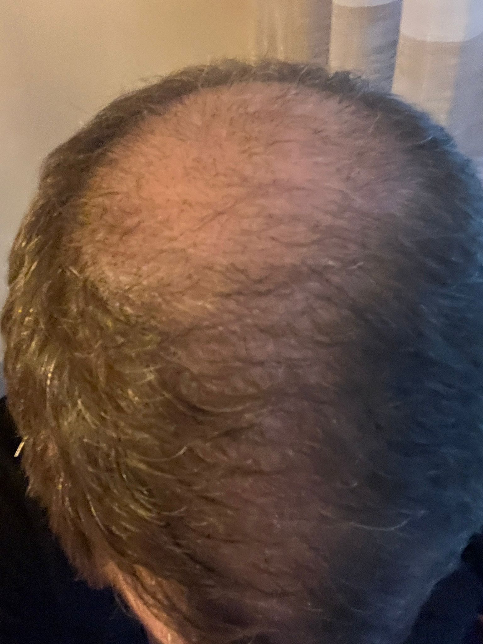 /foren/transplant/index.php/fa/63810/0/