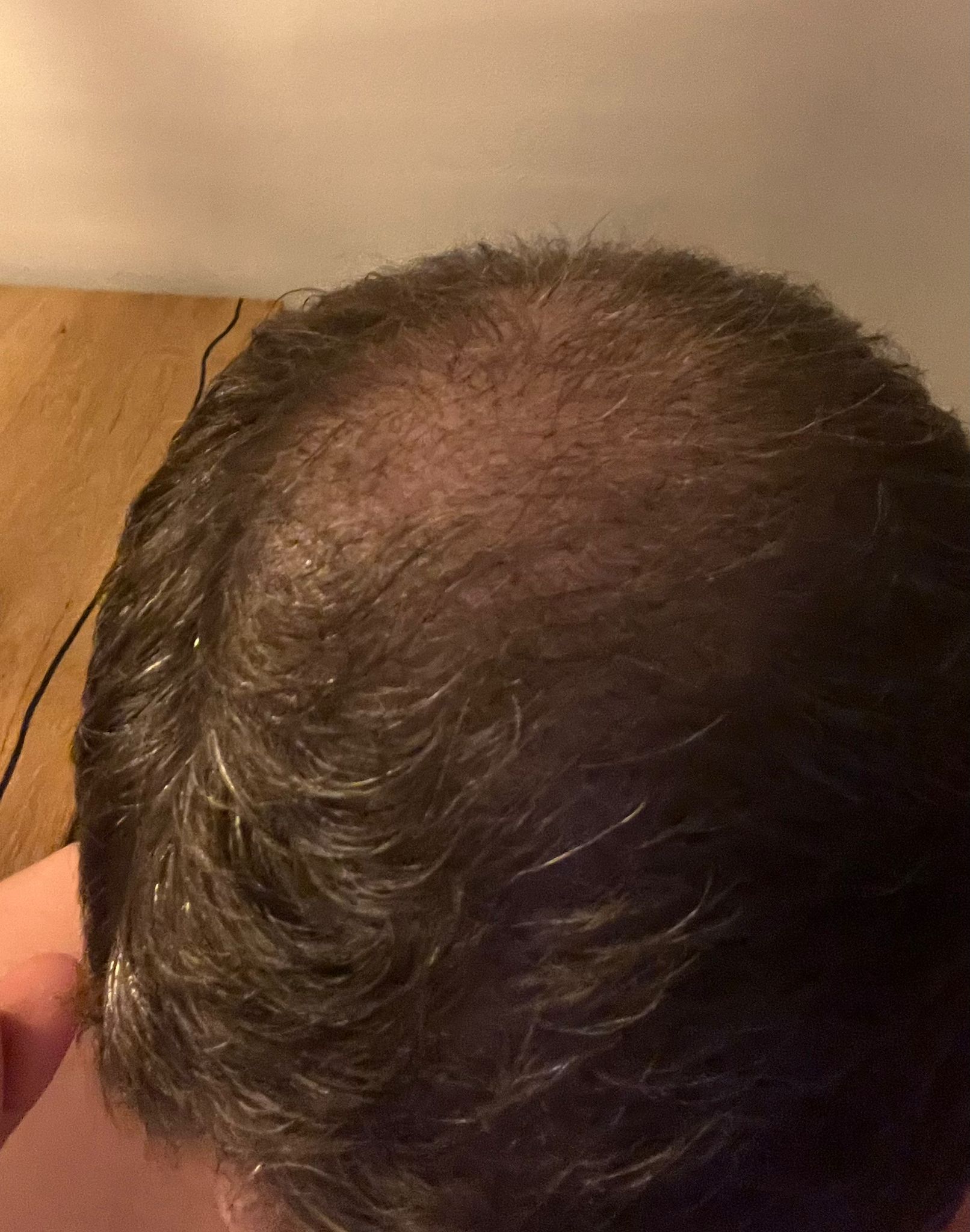 /foren/transplant/index.php/fa/63813/0/