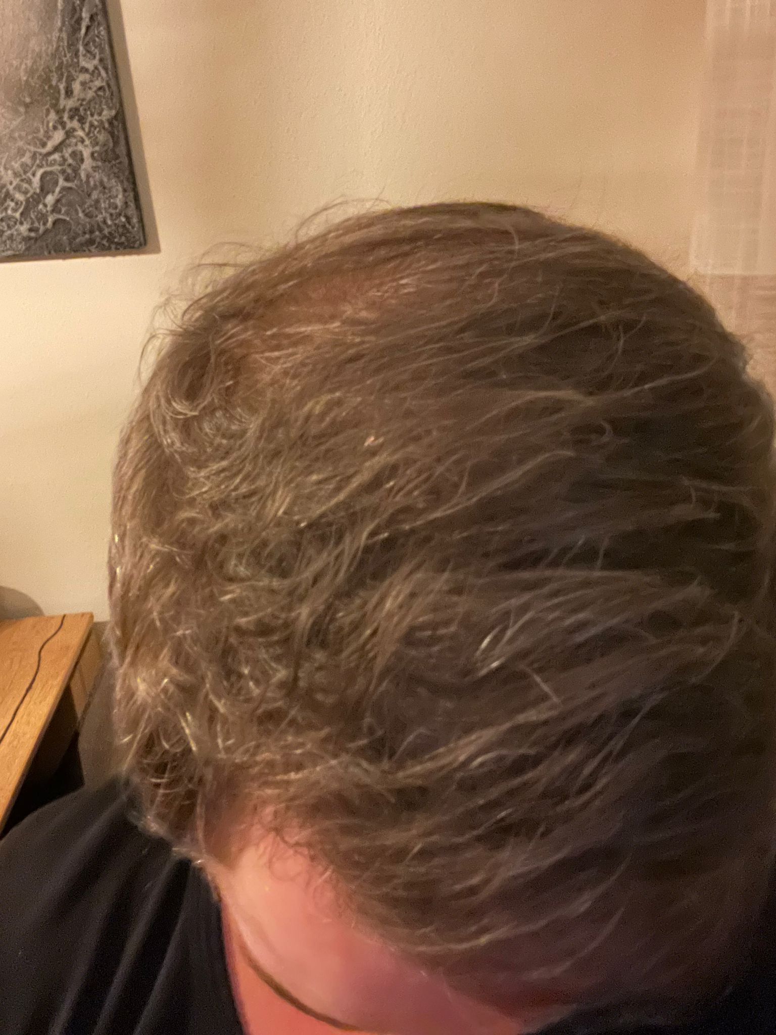 /foren/transplant/index.php/fa/63827/0/