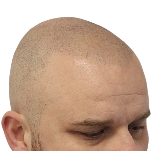 /foren/transplant/index.php/fa/64104/0/