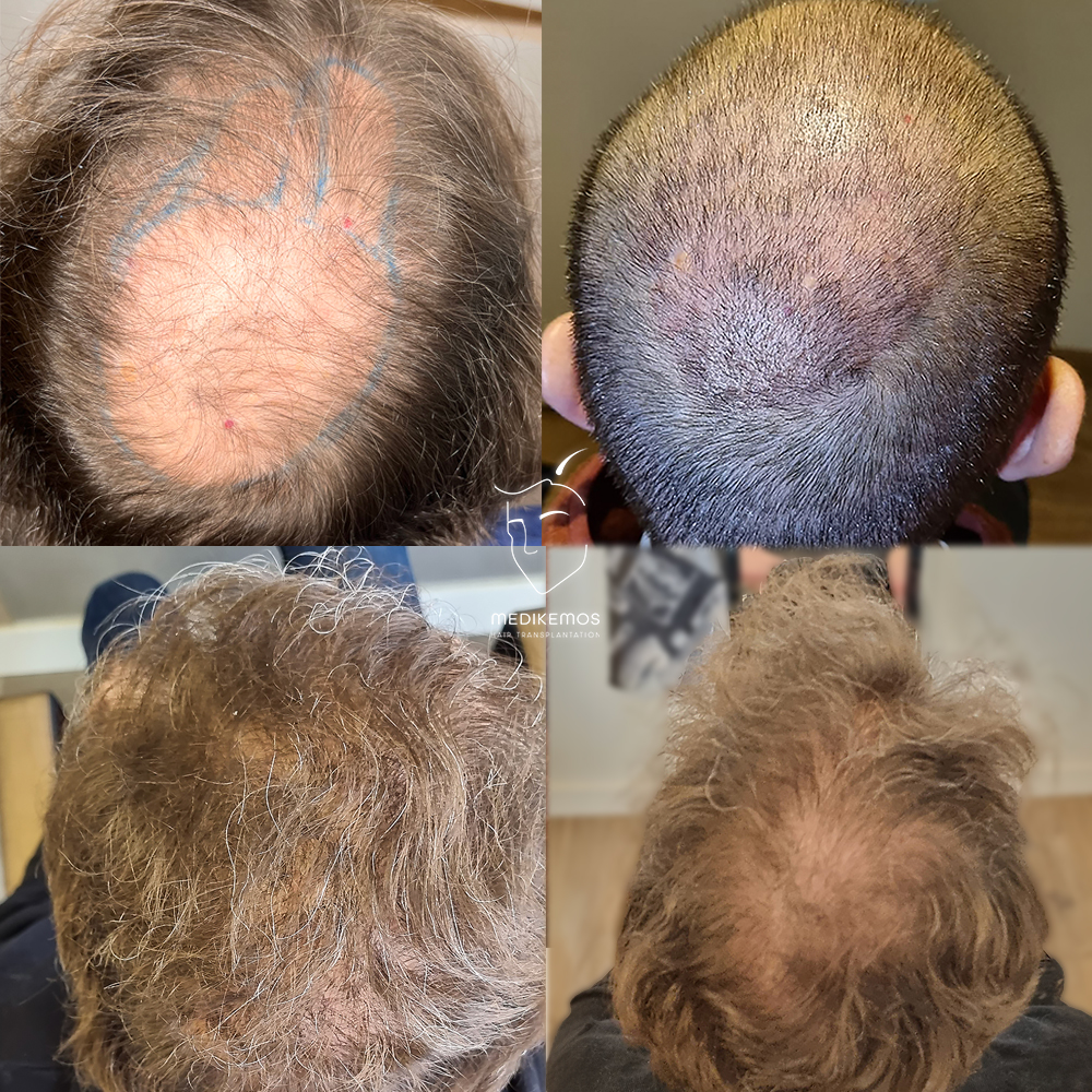 /foren/transplant/index.php/fa/64126/0/