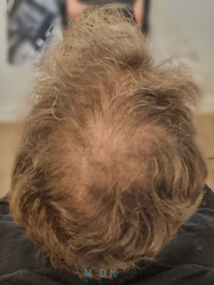 /foren/transplant/index.php/fa/64127/0/