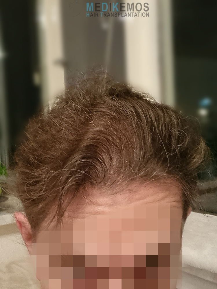 /foren/transplant/index.php/fa/64128/0/