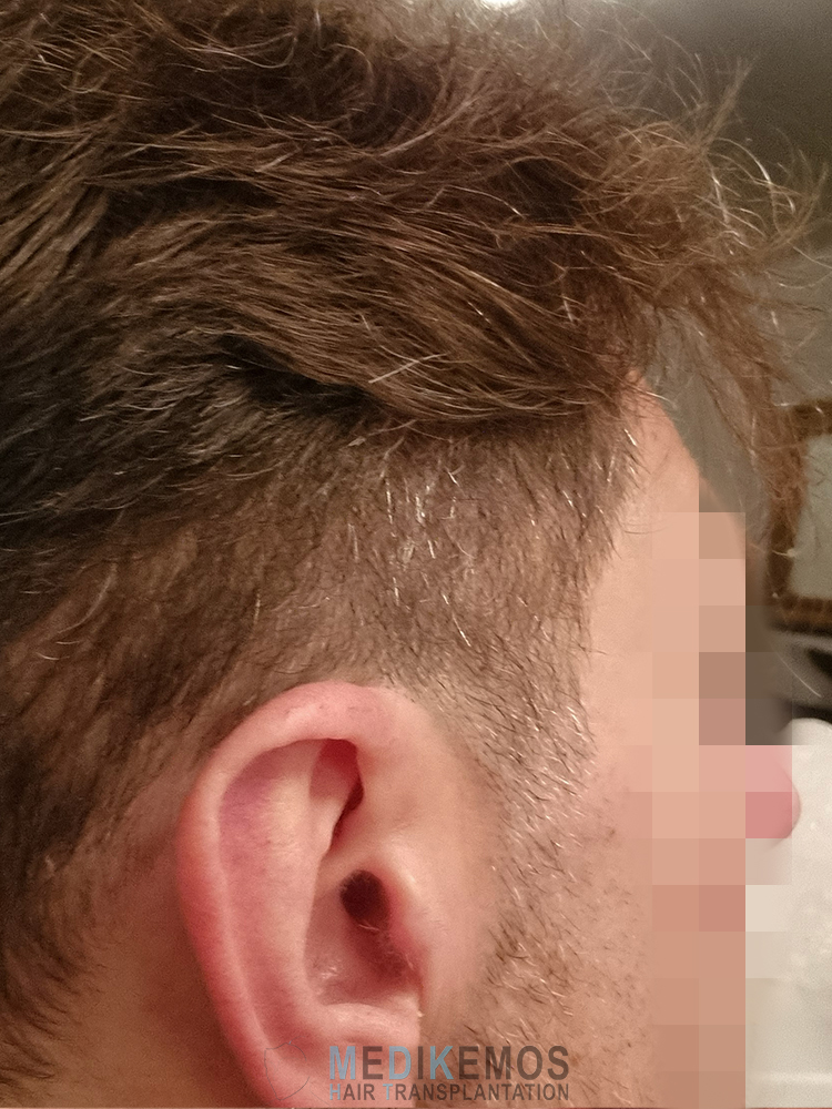 /foren/transplant/index.php/fa/64129/0/