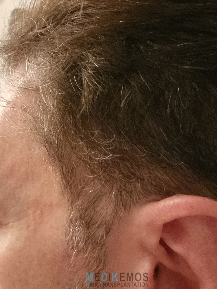 /foren/transplant/index.php/fa/64130/0/