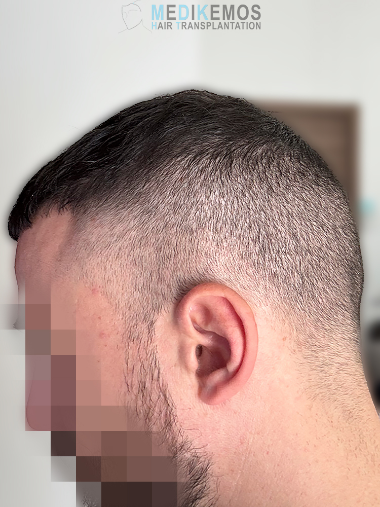 /foren/transplant/index.php/fa/64216/0/