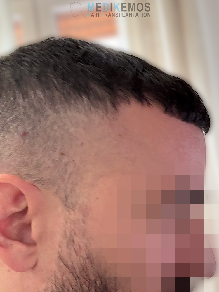 /foren/transplant/index.php/fa/64217/0/