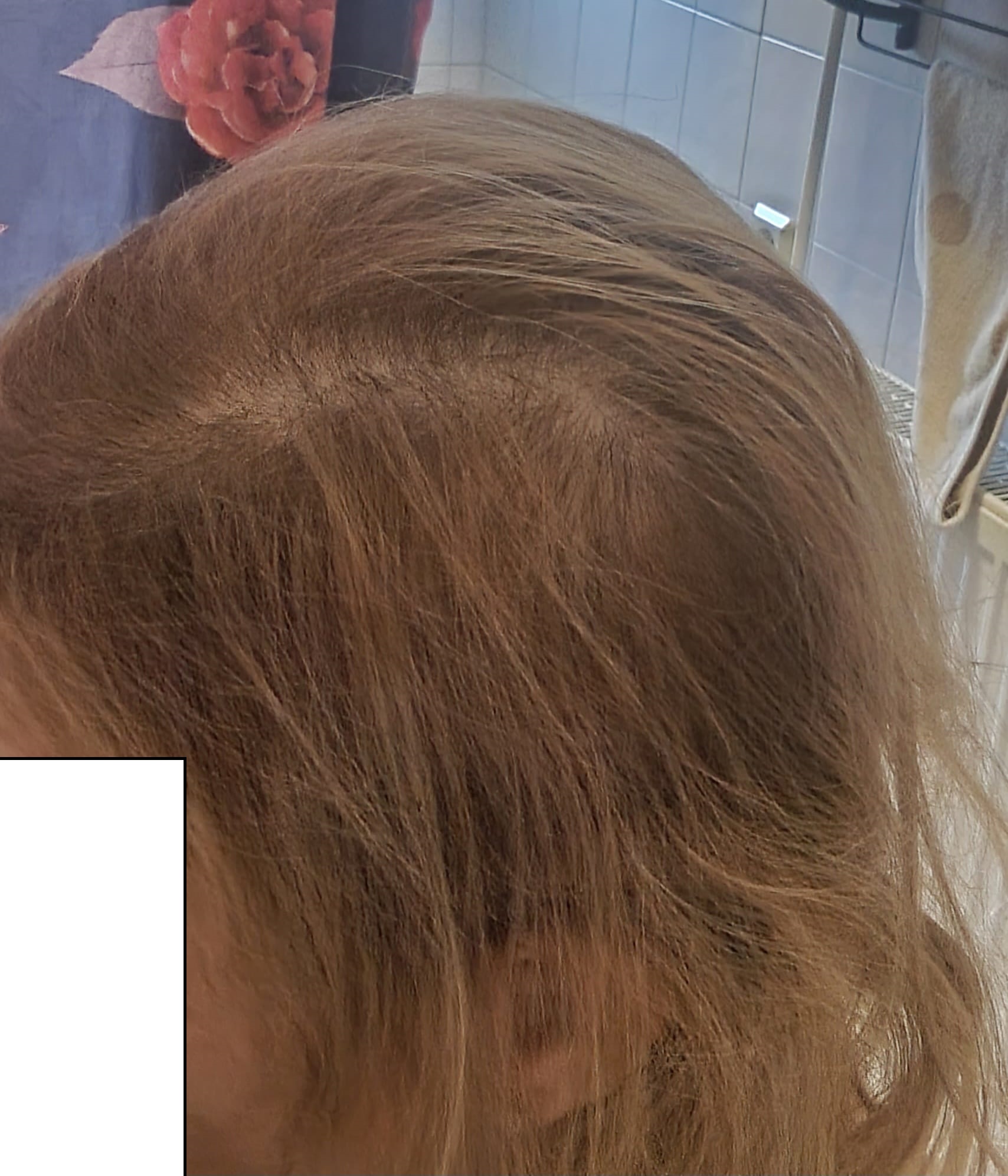 /foren/transplant/index.php/fa/64375/0/