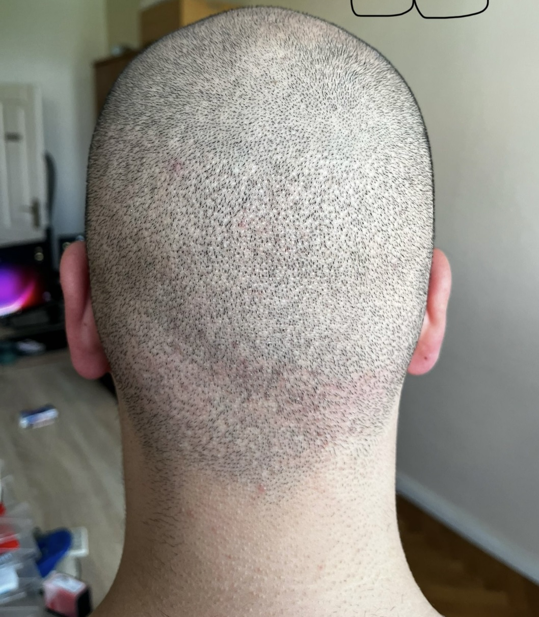 /foren/transplant/index.php/fa/64412/0/