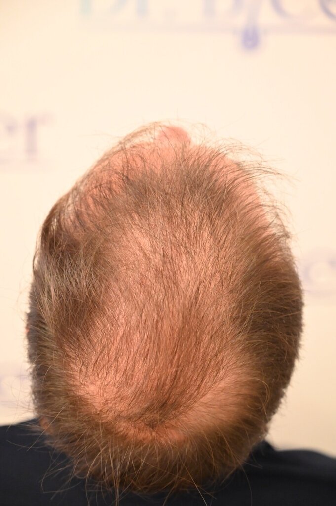 /foren/transplant/index.php/fa/64466/0/