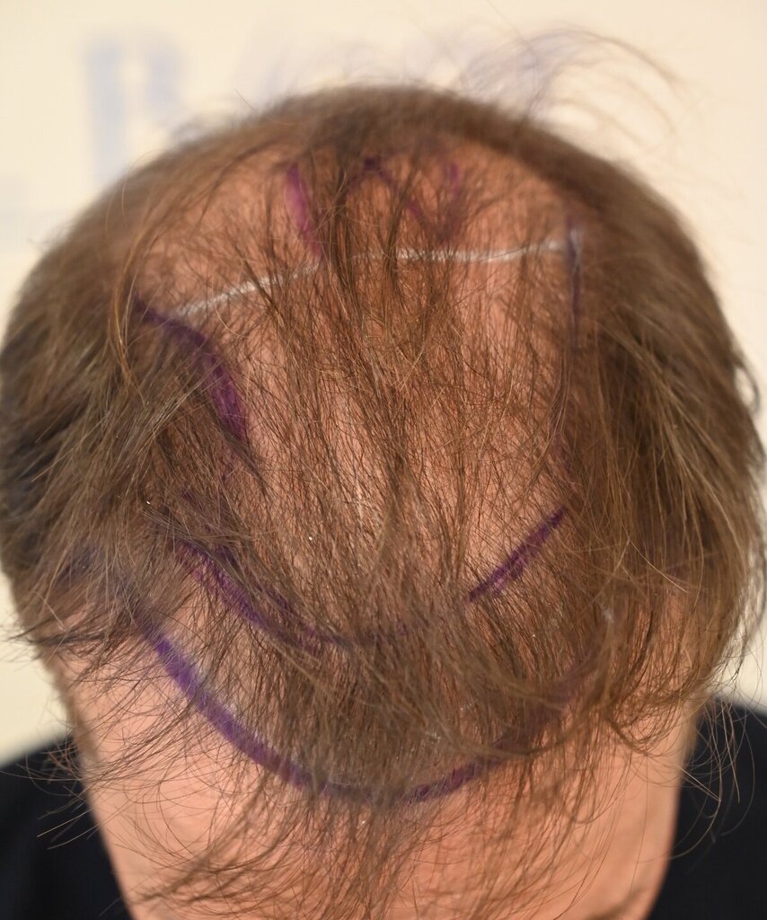 /foren/transplant/index.php/fa/64467/0/