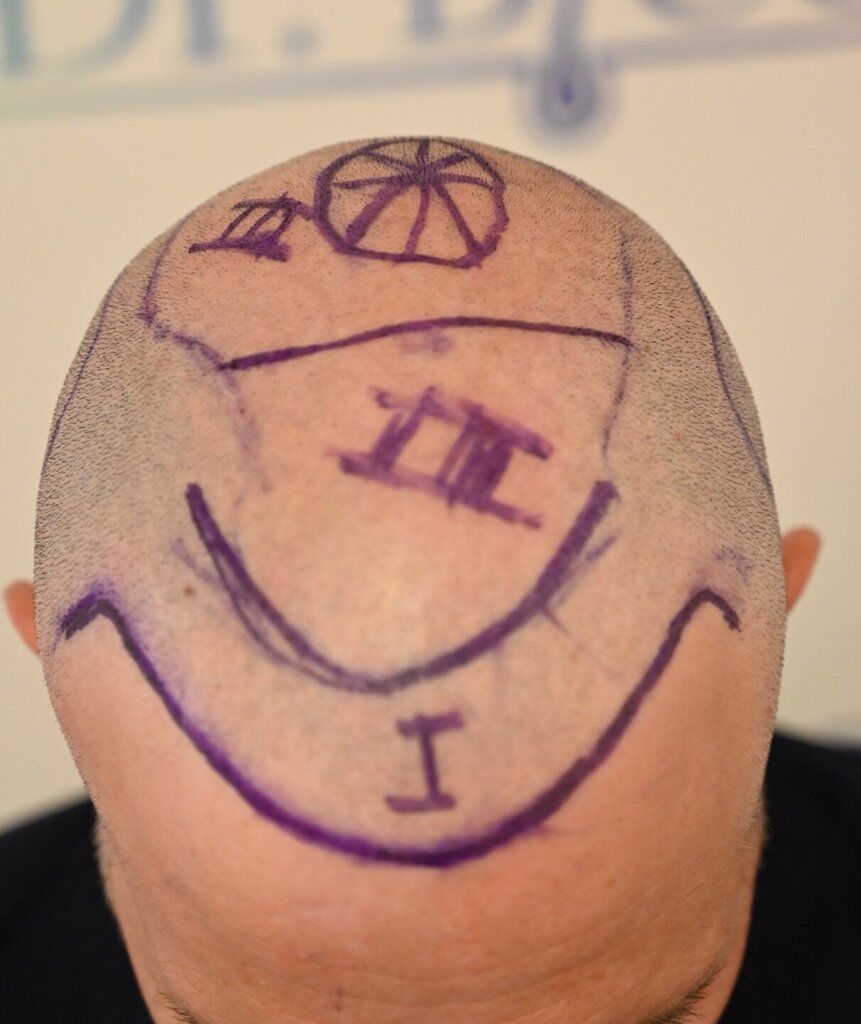 /foren/transplant/index.php/fa/64468/0/