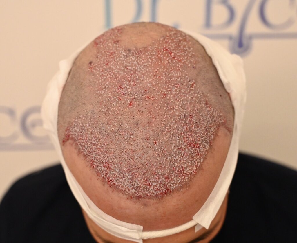 /foren/transplant/index.php/fa/64469/0/